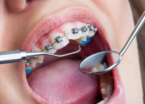 電動牙刷使用 電動牙刷